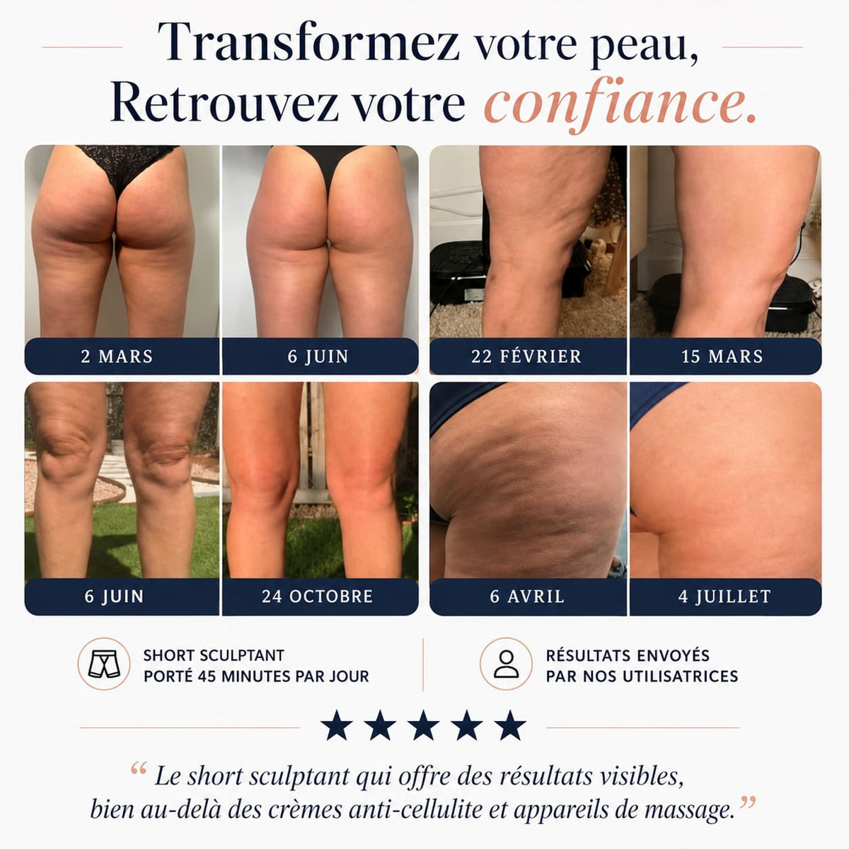 Short Sculptant 3D - Anti-Cellulite